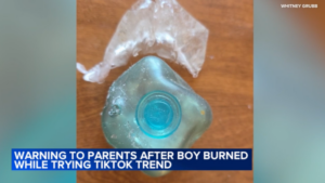 Illinois boy severely burned after following TikTok trend; hospital spreads awareness